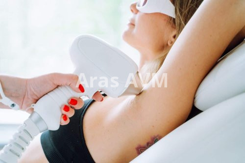 Lazer Epilasyon Nedir?