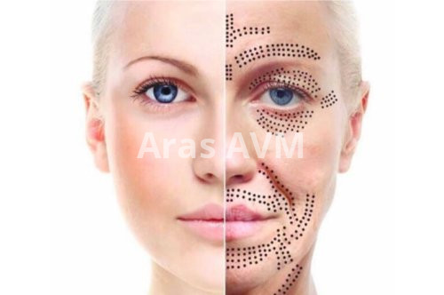 Profesyonel Plazma Pen Cihazları ve Fiyatları | Arasavm